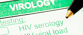 Detalle de una prueba de HIV. © RapidEye/Eyestockphoto